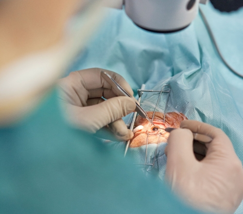 1 Augenoperation